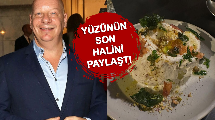 Ünlü komedyen Jeff Ross dondurma yedikten sonra hastanelik oldu! Yüzünün son halini paylaştı