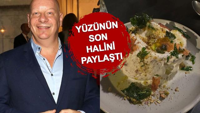 Ünlü komedyen Jeff Ross dondurma yedikten sonra hastanelik oldu! Yüzünün son halini paylaştı