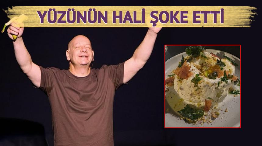 Ünlü komedyen Jeff Ross dondurma yedi, hastanelik oldu! Yüzünü aynada görünce çok korktu