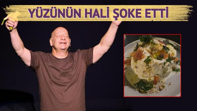 Ünlü komedyen Jeff Ross dondurma yedi, hastanelik oldu! Yüzünü aynada görünce çok korktu