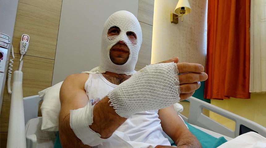 Nişanlısına sürpriz yapacaktı faciayı yaşadı! Sprey boya bomba gibi patladı: Hastanede yatarken evi yandı