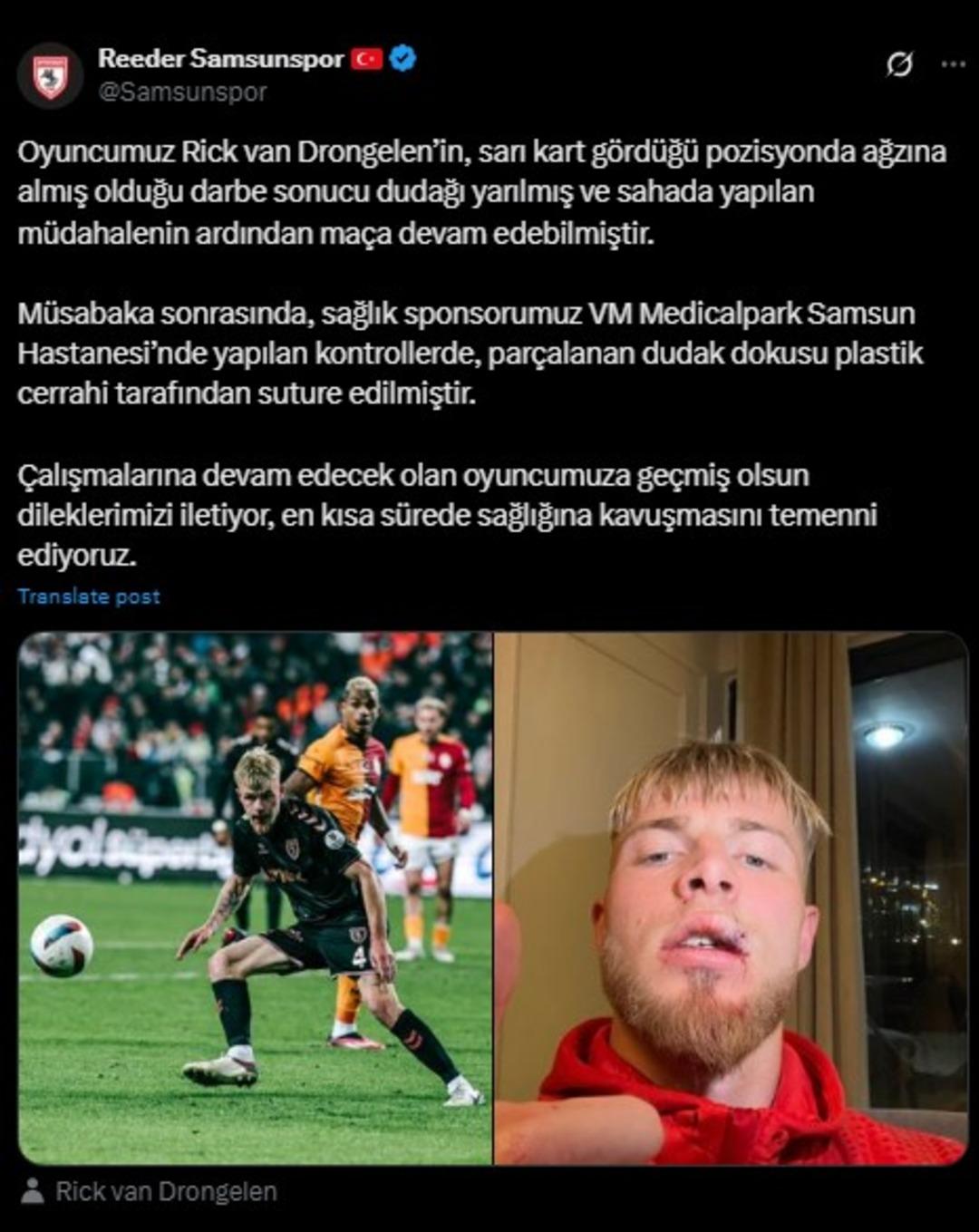 Dudağı yarılmış şeklinde fotoğrafını paylaştı! Samsunspor cephesinden sakatlık açıklaması... 1