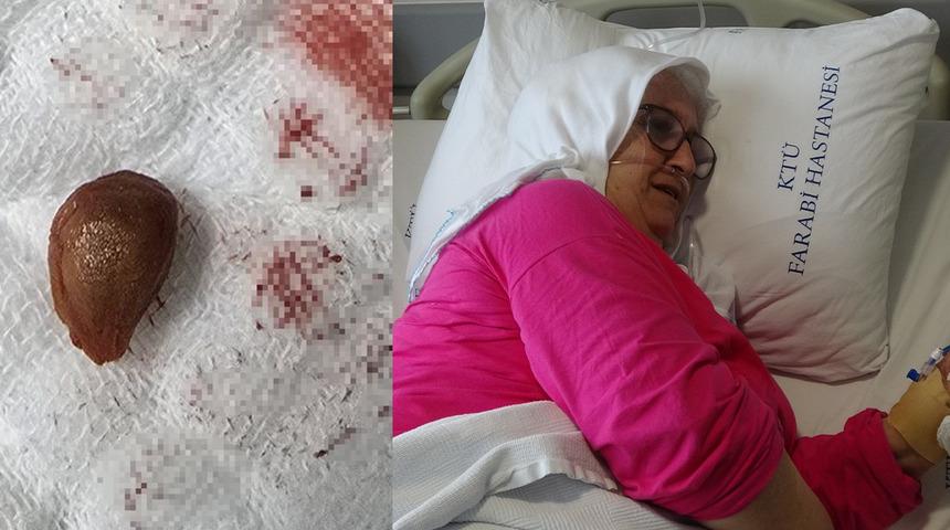 Karayemiş çekirdeği canını alıyordu: Akciğerinde çürümeye neden oldu!