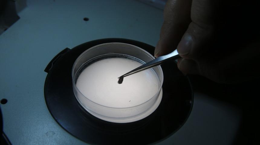 Tokat Gaziosmanpaşa Üniversitesinin laboratuvarında 30 bini aşkın kene bilimsel çalışmalar için saklanıyor