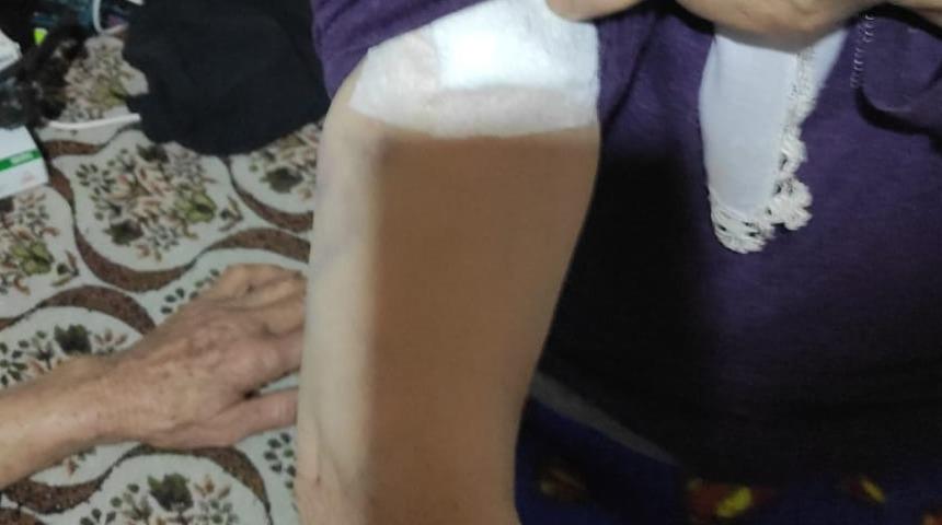 Burdur'da sahipsiz köpeklerin saldırdığı kadın yaralandı