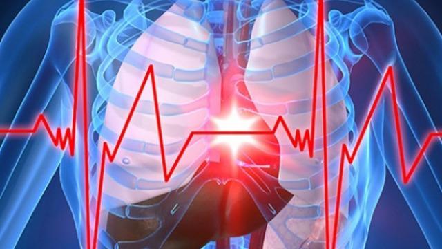 Sırrı Süreyya Önder'in geçirdiği kalp krizi ve aort diseksiyonu nedir? Uzmanlar açıkladı...