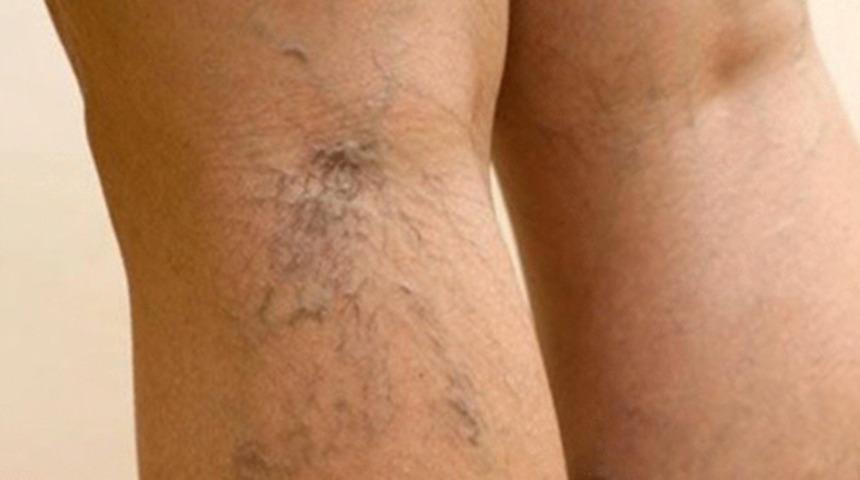 Varisi olanlara hava değişimi uyarısı!