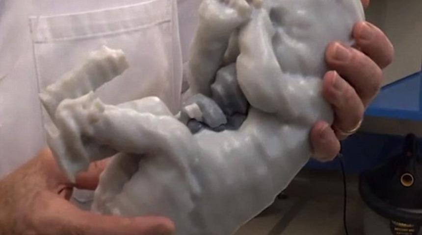 Kalbi ve karaciğeri dışarıda doğdu