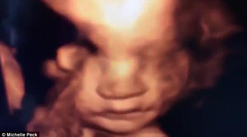 Bebeğin ultrason g&ouml;r&uuml;nt&uuml;s&uuml; şaşkına &ccedil;evirdi