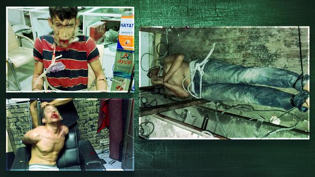 Eski patrondan 3 gün süren korkunç işkence: Dişleri kırıldı, hamam böceği yedirildi! Adli Tıp'tan gelen rapora inanamadı