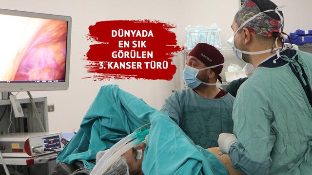 Dünyada en sık görülen 3. tehlikeli hastalık: Kolorektal kanseri... Uzmanlar uyarıyor: 20'li yaşlara kadar indi, çok fazla artmış durumda