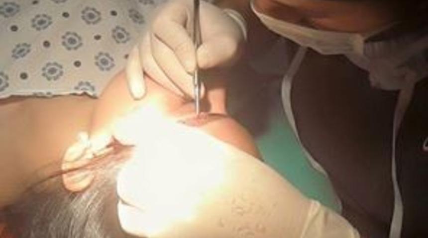 Kaş d&ouml;k&uuml;lmesi y&uuml;z ifadesini etkiliyor