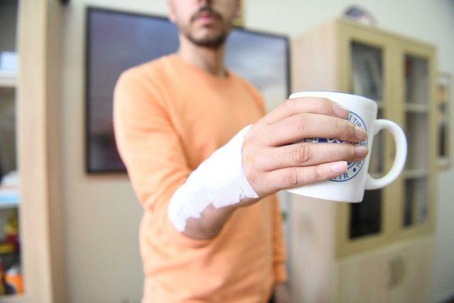 Ege Üniversitesi'nde el bileği protezi geliştirildi