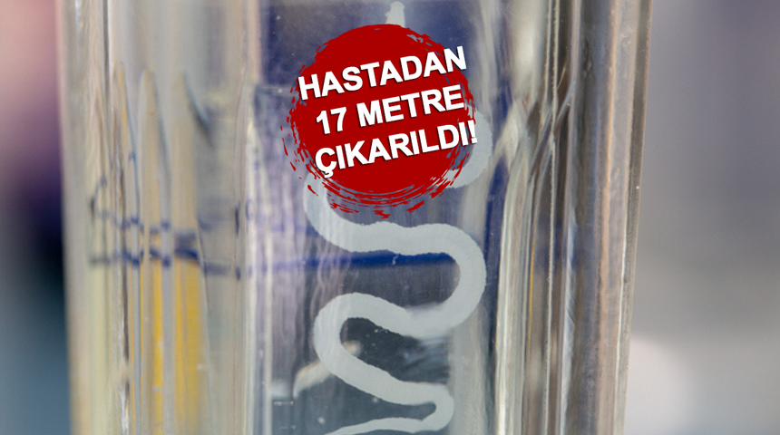 Organları yiyip öldürüyor! Avrupa'dan ABD'ye yayıldı, acil uyarı yapıldı! Bir hastadan 17 metre çıkarıldı...