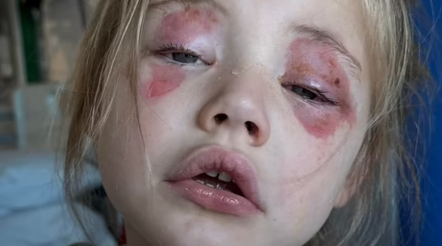 Annelere uyarı: Her evde kullanılıyor! 4 yaşındaki çocuk ısırınca kör oldu, hayatı mahvoldu