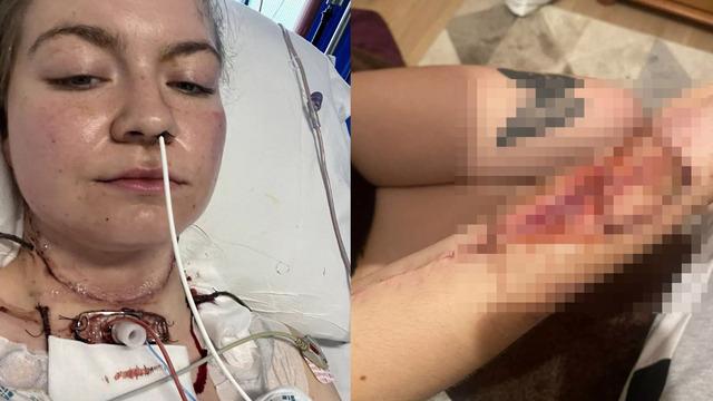 Konuşurken acı çekiyordu, ağız ülseri sandı! Umursamayınca hayatı karardı! Gerçek bambaşka çıktı...