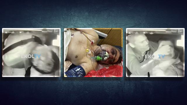 İngiliz boksör tarafından öldüresiye darbedilmişti... Yaşadığı dehşetin görüntüleri ortaya çıktı! 