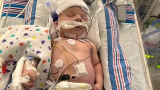 Yenidoğan bebek sünnet oldu, doktorun hatası hayatını mahvetti! Yaşam savaşı veriyor...