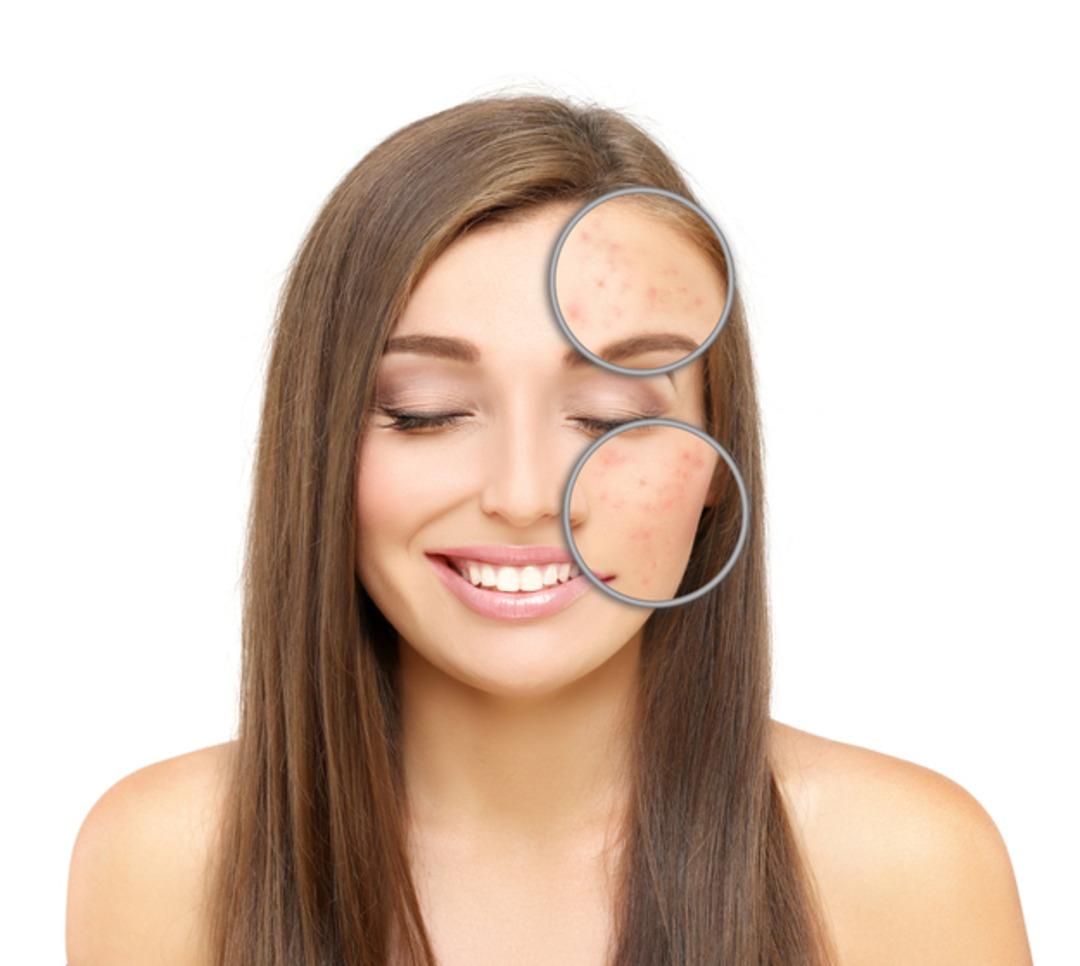 iStock-660960990