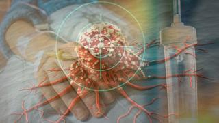 Kanserin şifresi: Yapay Zeka ve genetik bilim, teşhis edilmeden uyaracak! Uzmanlar: Bazen bir insanın doğduğu gün kansere yakalanacağı bellidir