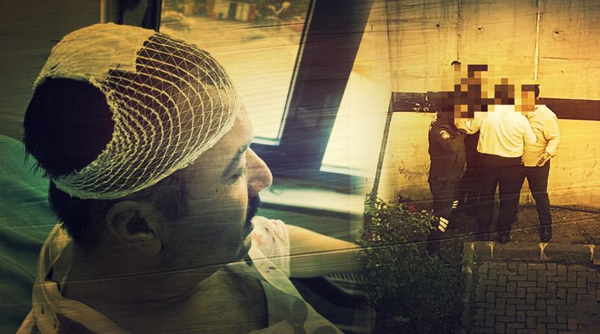 Belediye içinde başkanların akılalmaz kavgası! Kafasına şekerlikle vurdu, görevden alındı