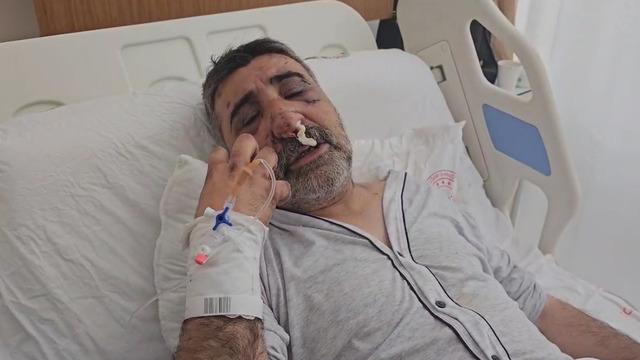 Öldüresiye darbedilen taksici yaşadığı dehşeti anlattı! Gözümü yırtmaya çalışıp ısırdı