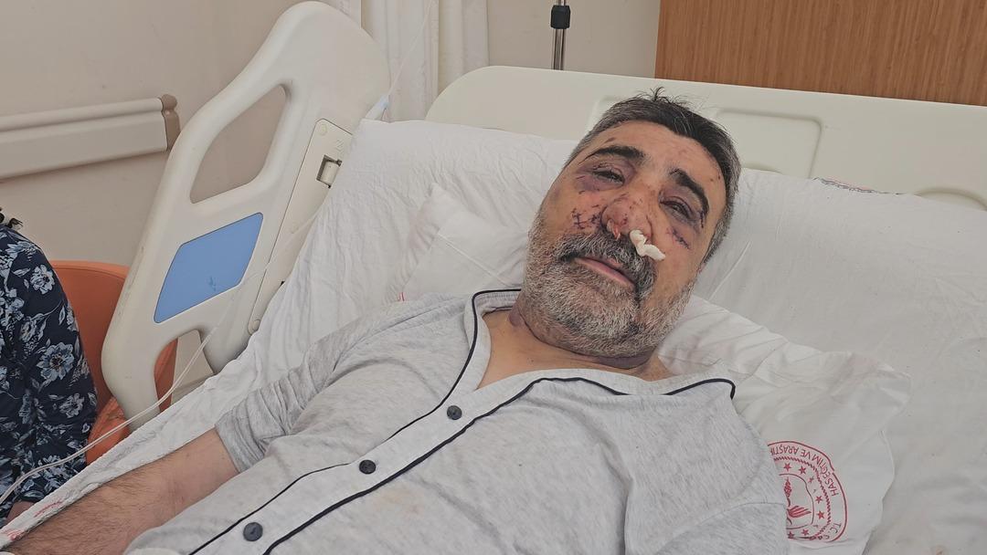 Öldüresiye darbedilen taksici yaşadığı dehşeti anlattı! "Gözümü yırtmaya çalışıp ısırdı" 3