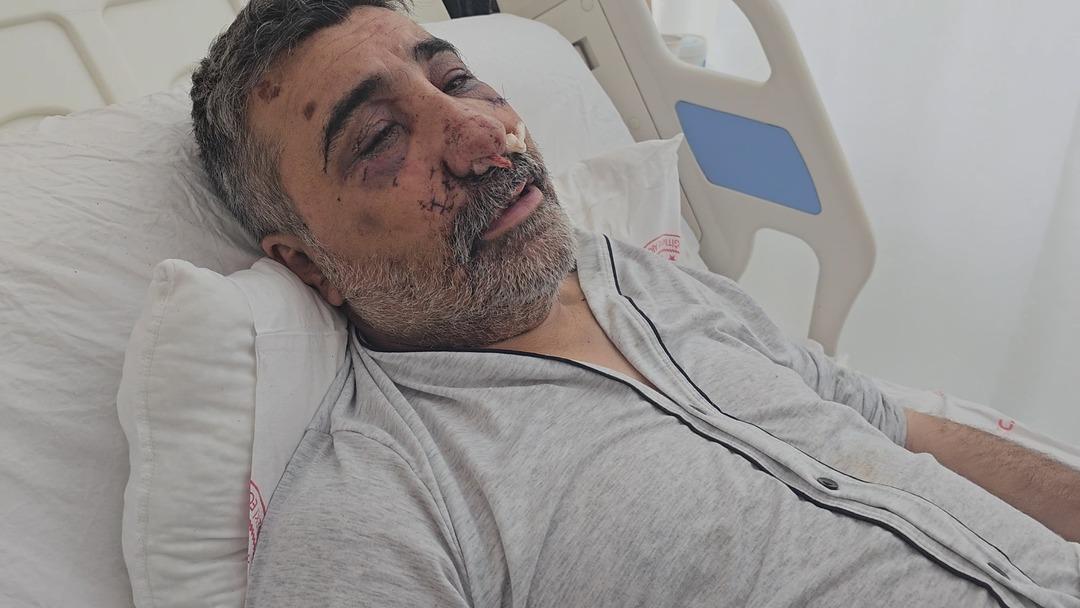 Öldüresiye darbedilen taksici yaşadığı dehşeti anlattı! "Gözümü yırtmaya çalışıp ısırdı" 2