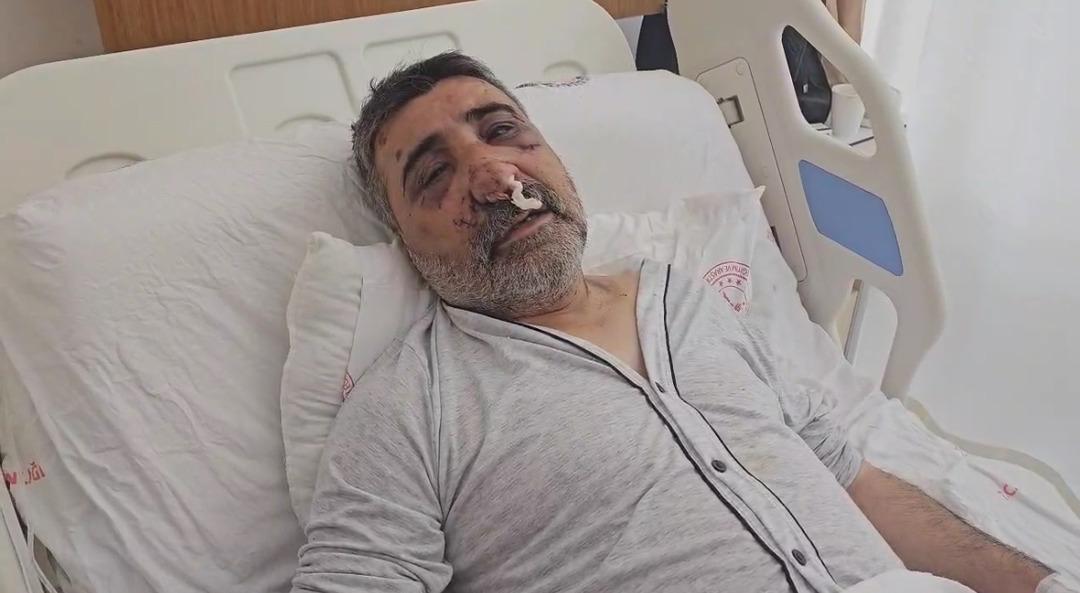 Öldüresiye darbedilen taksici yaşadığı dehşeti anlattı! "Gözümü yırtmaya çalışıp ısırdı" 1