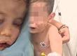 Vahşet! 2 yaşındaki bebek darp edildi, hayati tehlikesi bulunuyor