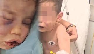 Vahşet! 2 yaşındaki bebek darp edildi, hayati tehlikesi bulunuyor