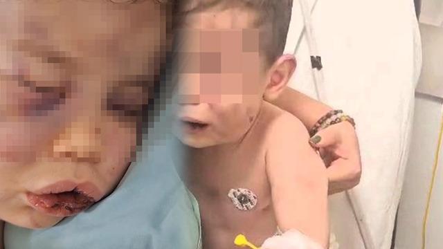 Vahşet! 2 yaşındaki bebek darp edildi, hayati tehlikesi bulunuyor