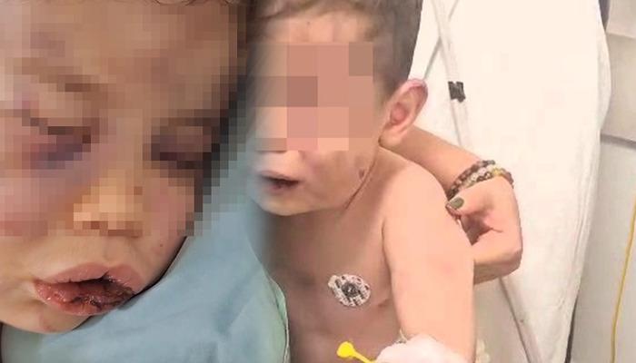 Vahşet! 2 yaşındaki bebek darp edildi, hayati tehlikesi bulunuyor