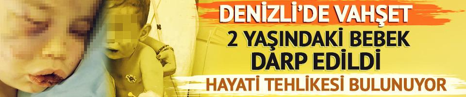 Vahşet! 2 yaşındaki bebek darp edildi, hayati tehlikesi bulunuyor
