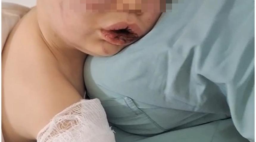 Darp sonucu hastanelik olan bebek devlet korumasına alınacak