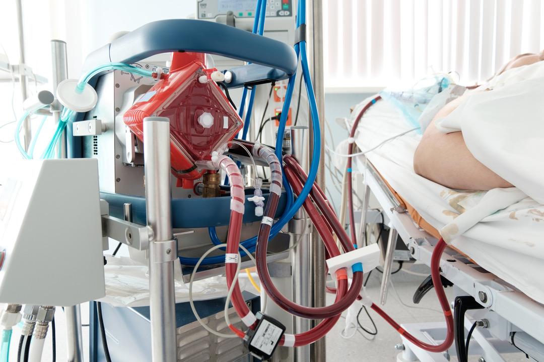 ECMO2
