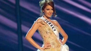 Eski Türkiye güzeli Senem Kuyucuoğlu ölümden döndü! Uyurken elektrik sobası tutuştu! Son hali korkuttu