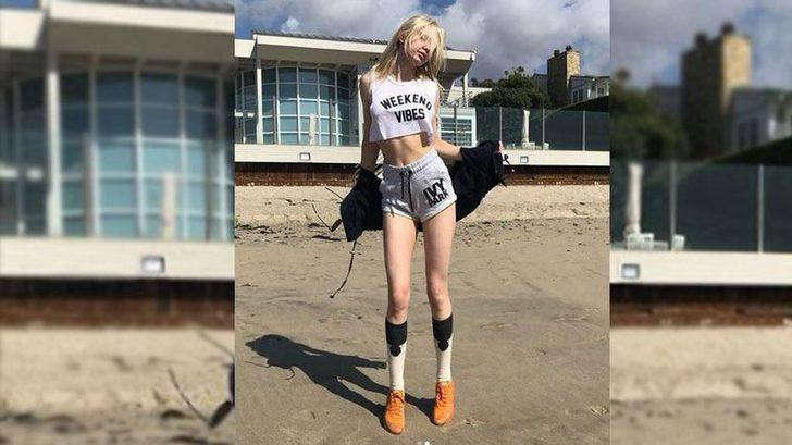 Aleyna Tilki photoshop mu yaptı? Şoke eden görüntü G1