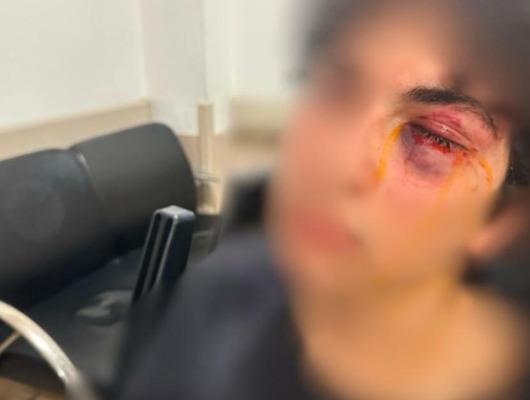CHP standında şarkıya eşlik eden 15 yaşındaki çocuk darbedildi