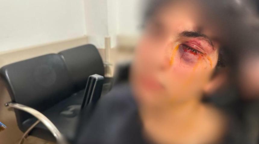 CHP standında çirkin saldırı! Standın başında şarkıya eşlik eden 15 yaşındaki çocuk darbedildi