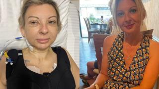 Türkiye'de estetik olan yabancı kadın kabusu yaşadı! Hem binlerce sterlin harcadı hem de pişman oldu