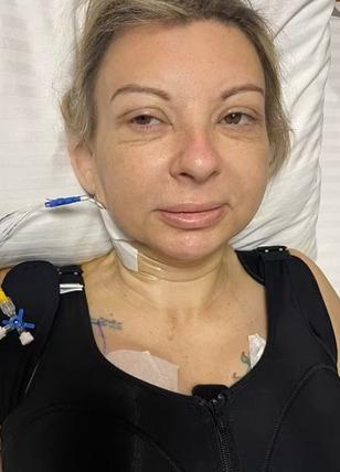 Türkiye'de estetik olmuştu! Yabancı kadın kabusu yaşadı