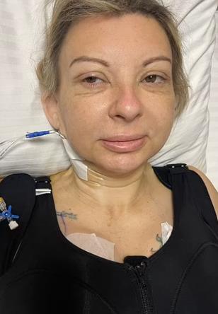 Türkiye'de estetik olmuştu! Yabancı kadın kabusu yaşadı