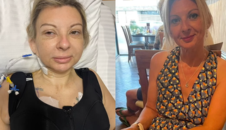 Türkiye'de estetik olmuştu! Yabancı kadın kabusu yaşadı, yaptırdığına pişman oldu