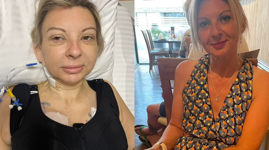 T&uuml;rkiye'de estetik olan yabancı kadın kabusu yaşadı! Hem binlerce sterlin harcadı hem de pişman oldu