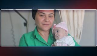 Yeni doğan bebeklerde nadir görülür...