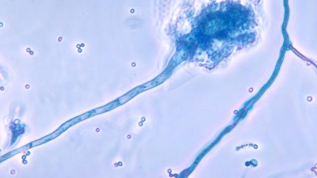 İngiltere'de korkutan araştırma! Ölümcül mantar hastalığı, küresel ısınmayla Avrupa ve Asya'ya doğru yayılabilir
