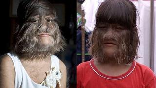 Dünyanın en tüylü kızıydı! Yeni aşkını paylaştı, son haliyle gündem oldu! 