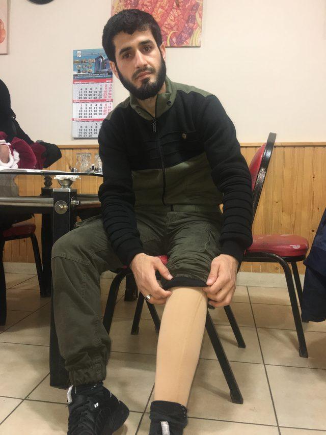 Protez bacaklı ÖSO mensubunun tek isteği Afrin'de savaşmak