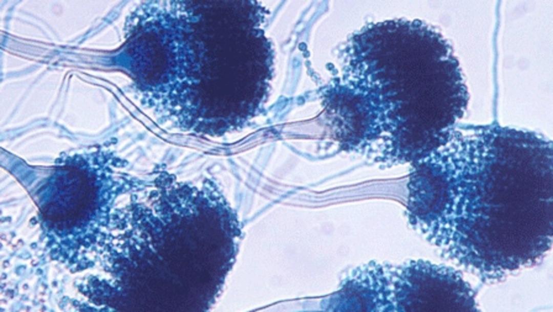 aspergillus-fumigatus
